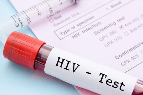 HIV test kits Bono Region Ghana cases