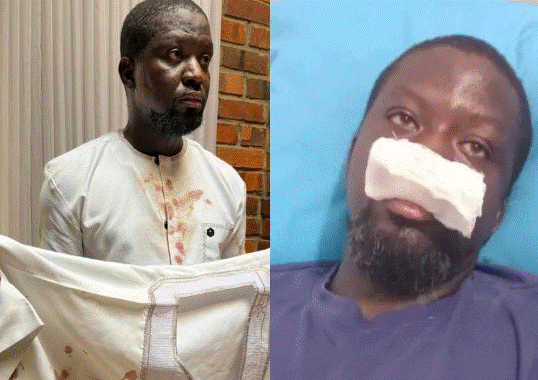 Mahama police assault Doctor petitions