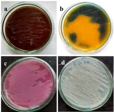 Uropathogens elderly Ghana